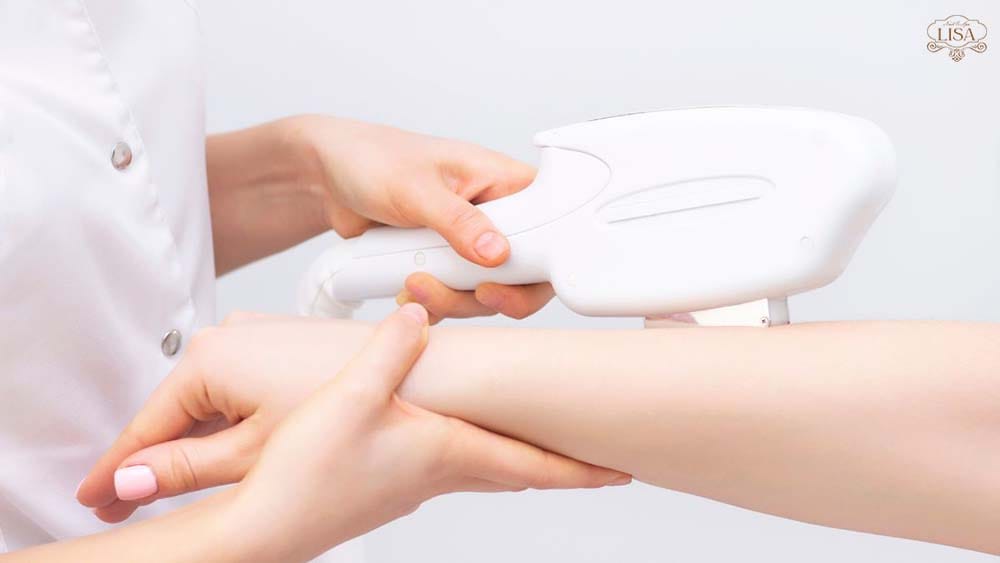 Cách triệt lông ở ngón tay giúp bàn tay mềm mịn cực xinh