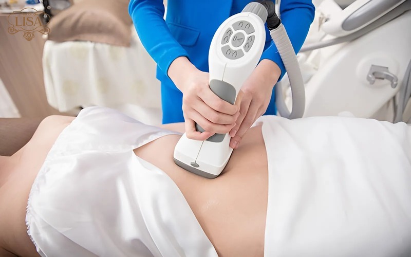 Công nghệ giảm béo laser