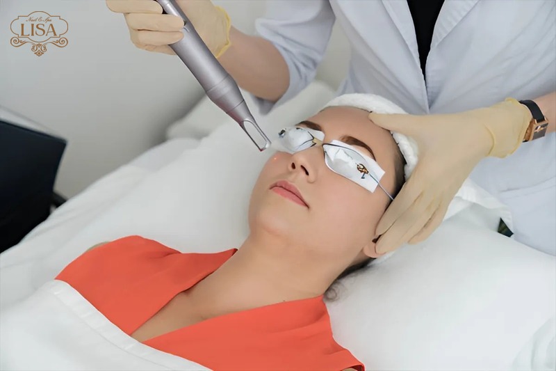 Công nghệ Trị mụn Pro Facial