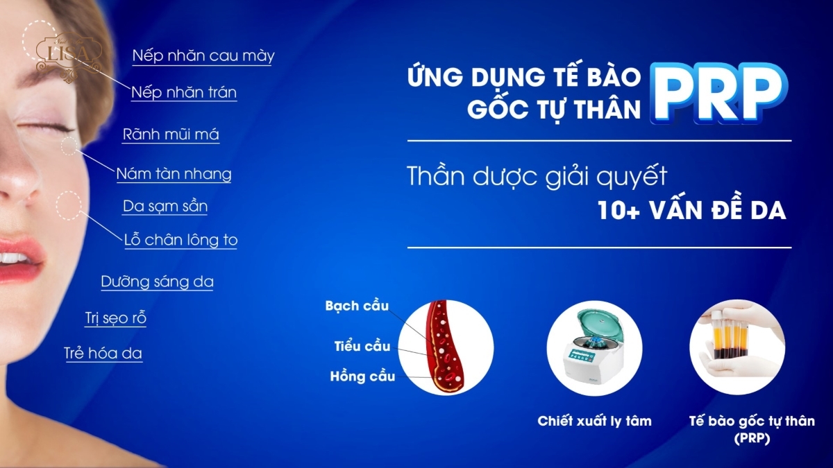 Công nghệ trẻ hóa da PRP