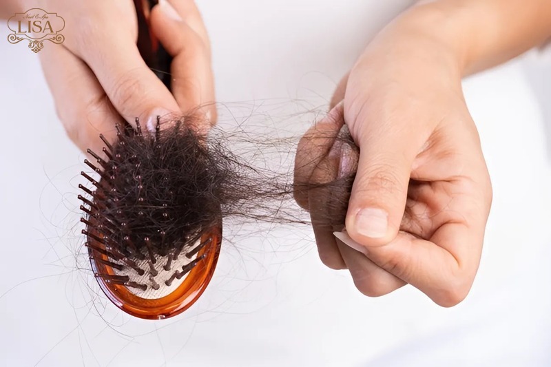 Một số nguyên nhân khiến tóc rụng khi gội