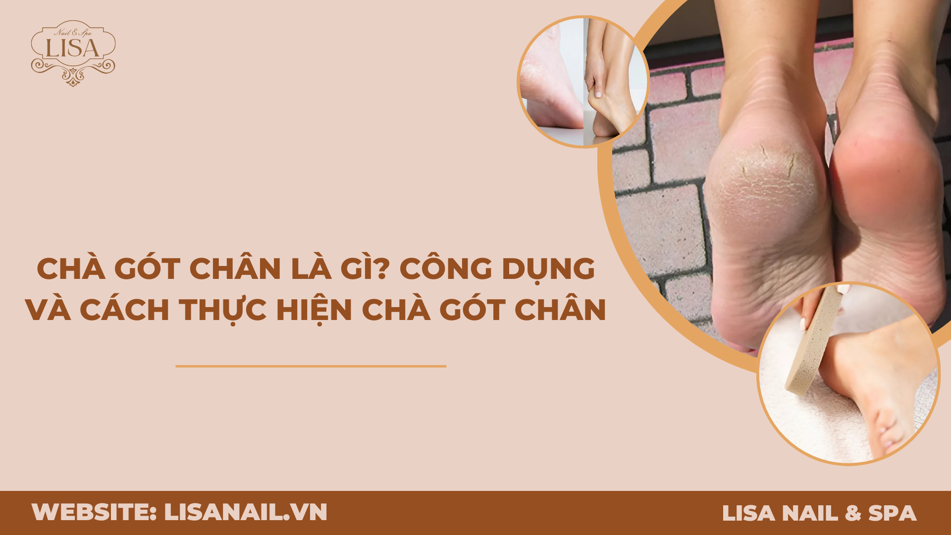 Chà gót chân là gì? Công dụng và cách thực hiện chà gót chân