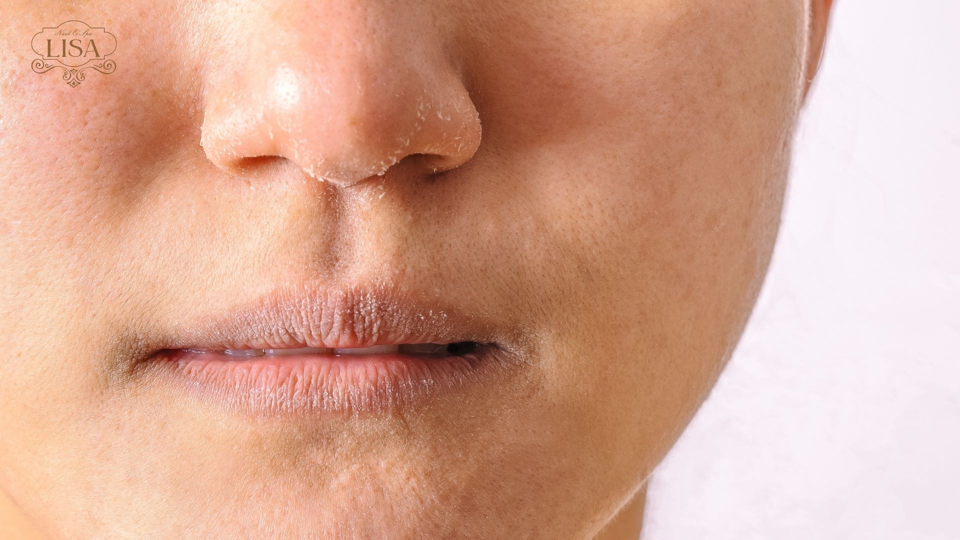 Da mất nước và giảm khả năng hydrat hóa