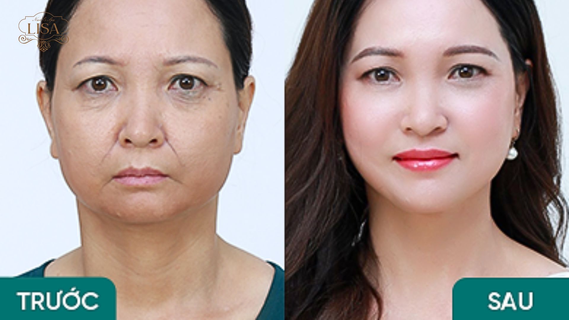 Dịch vụ spa tại Thẩm Mỹ Viện Đông Á