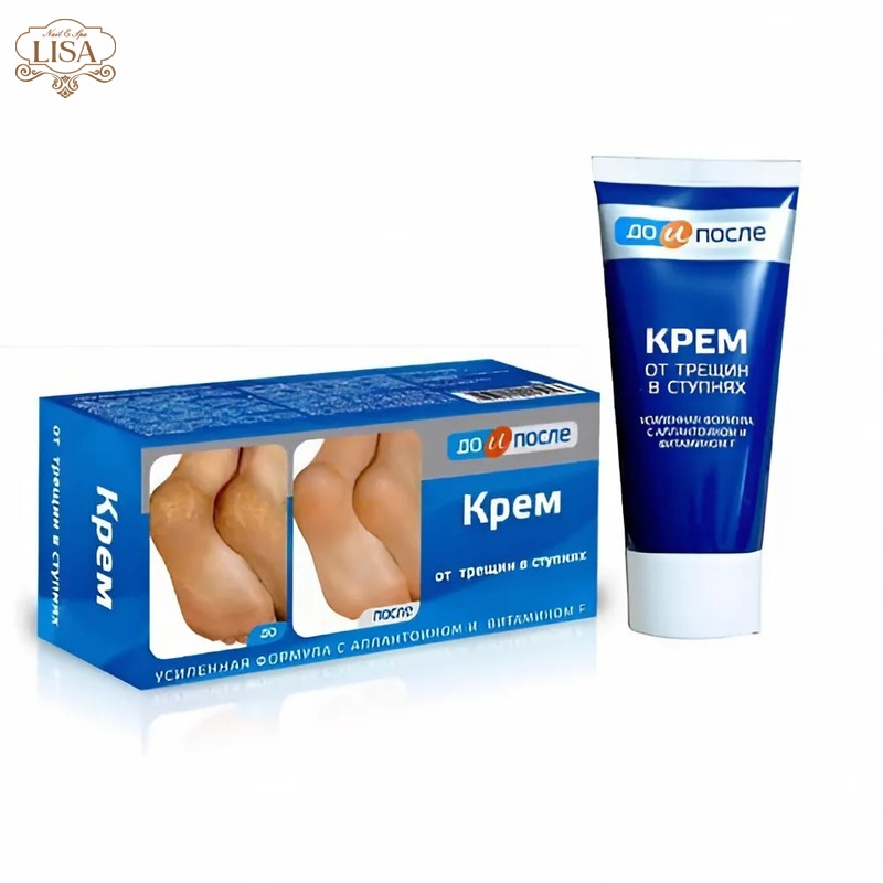 Kpem Apteka 50ml – Kem trị nứt gót chân xuất sứ Nga