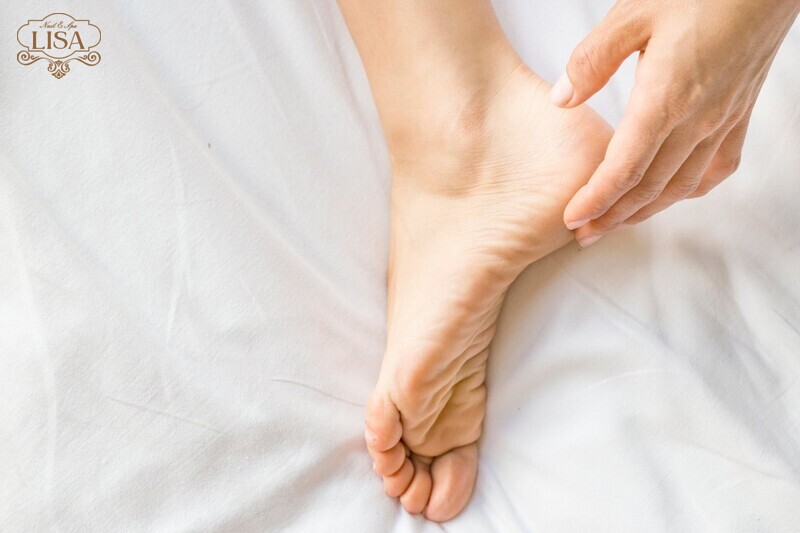 Làm sao để gót chân không bị nứt? Chuyên gia giải đáp