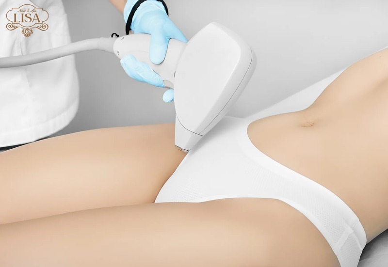 Những ai nên và không nên triệt lông bikini?