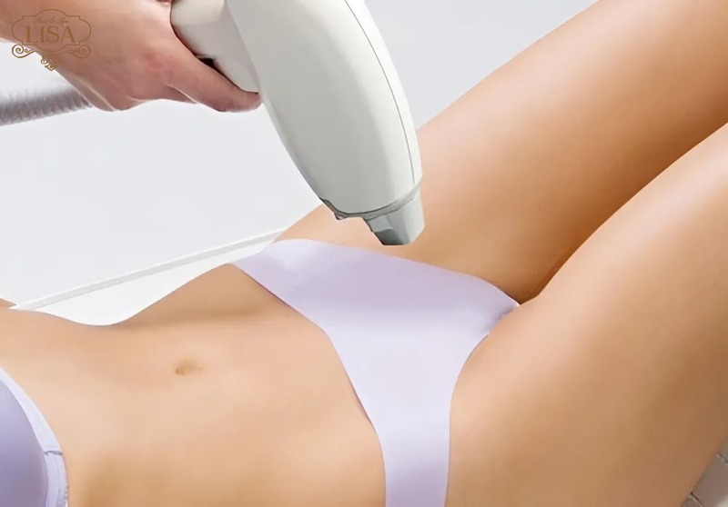 Triệt lông bikini là gì?