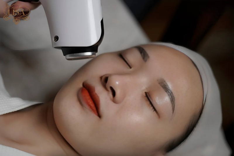 Ai không nên triệt lông vĩnh viễn?