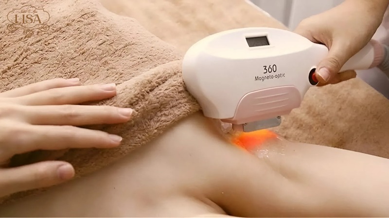 Ai nên và không nên lựa chọn triệt lông?