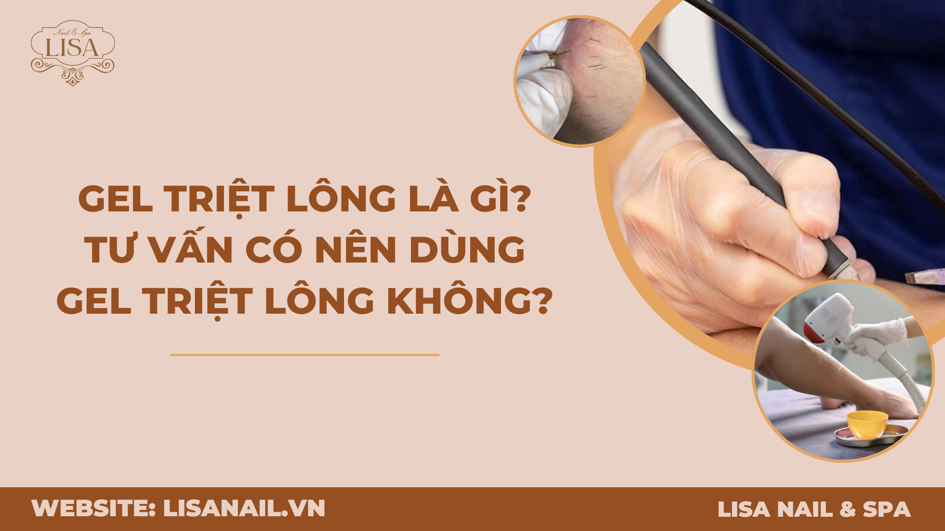Triệt lông điện phân là gì? Tác dụng, ưu nhược điểm ít ai biết