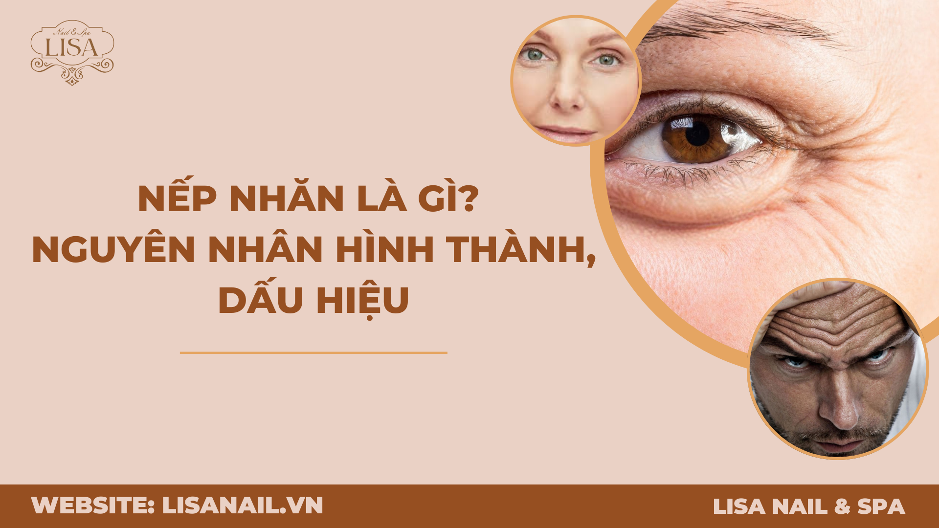 Nếp nhăn là gì? Nguyên nhân hình thành, dấu hiệu