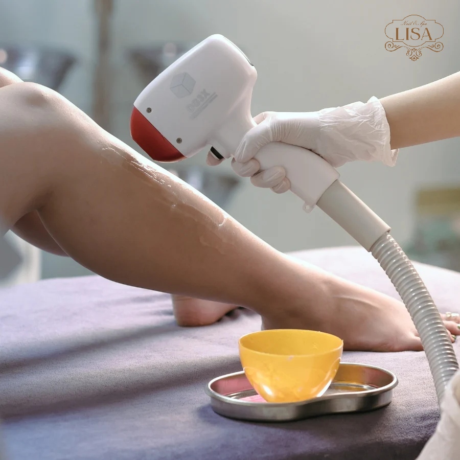 Triệt lông điện phân chân