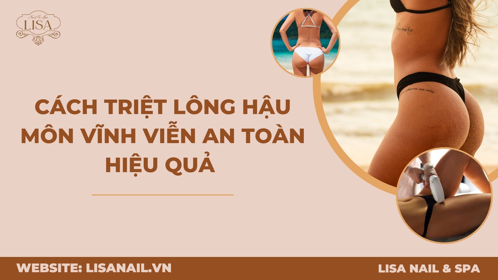 Cách triệt lông hậu môn vĩnh viễn an toàn hiệu quả