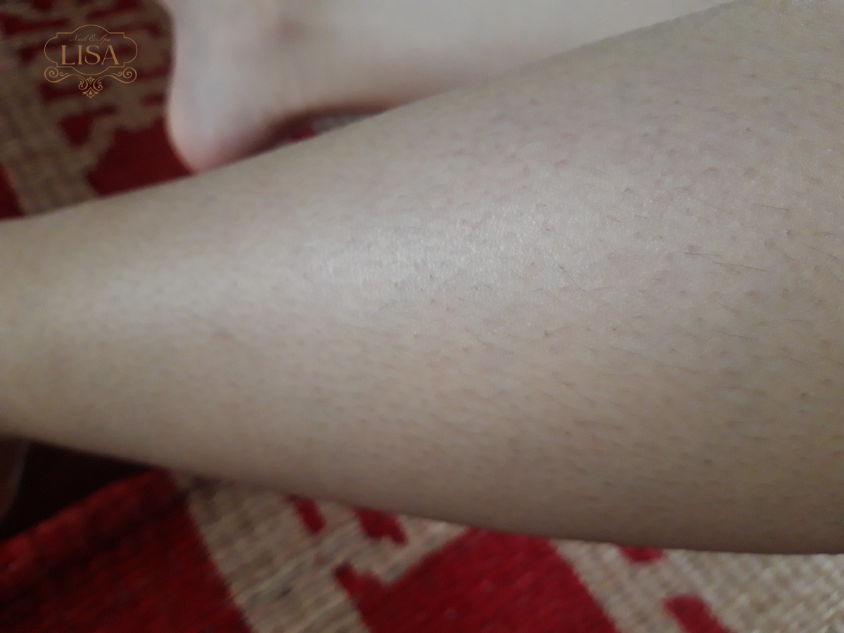 Dấu hiệu lông bất thường