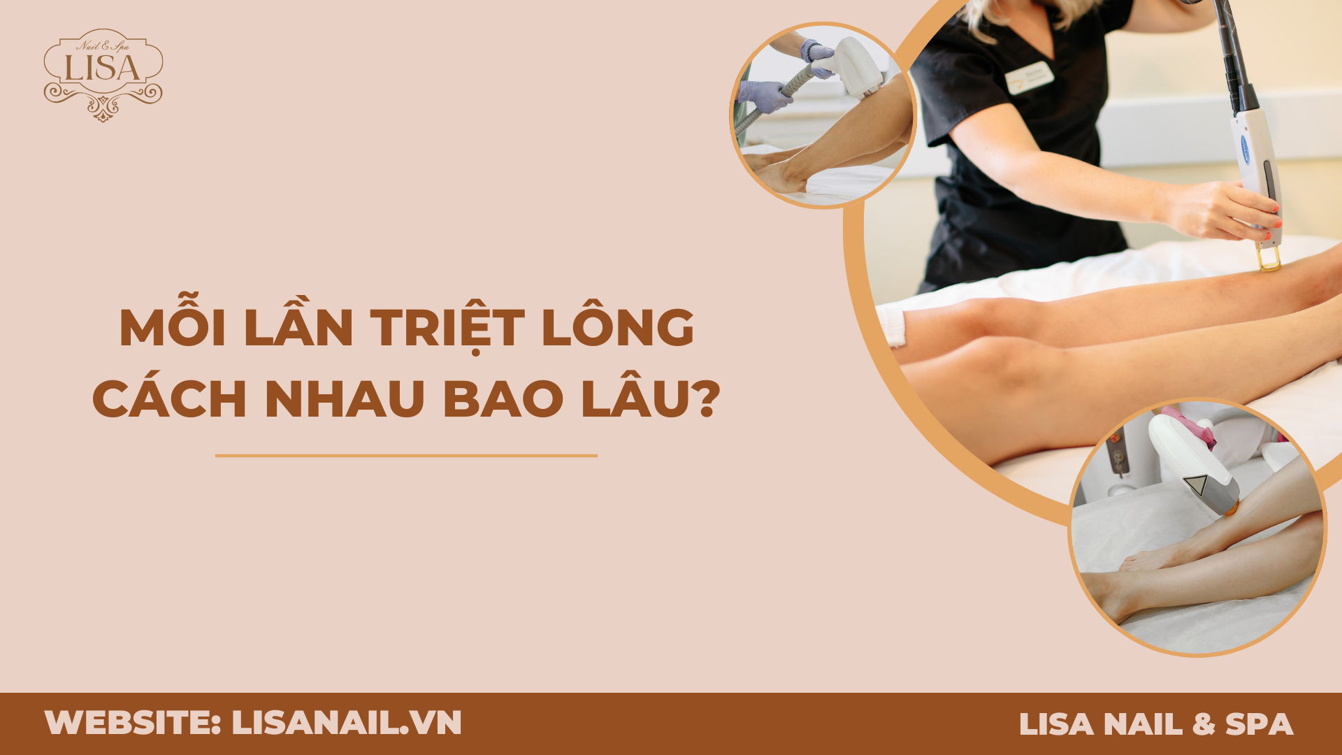 Mỗi lần triệt lông cách nhau bao lâu?