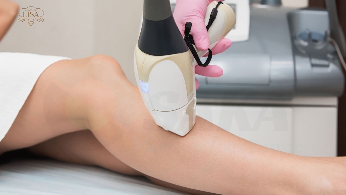 Triệt lông chân spa vĩnh viễn