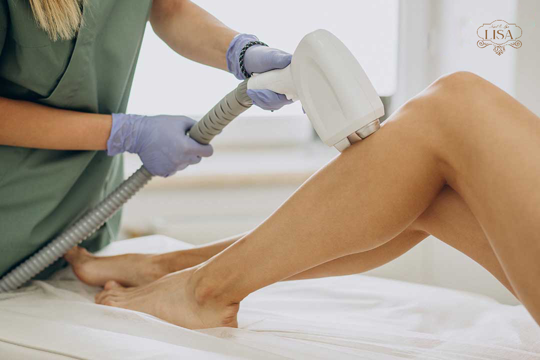 Triệt lông vĩnh viễn 4 tuần