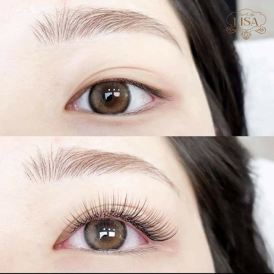 Trước và sau khi nối