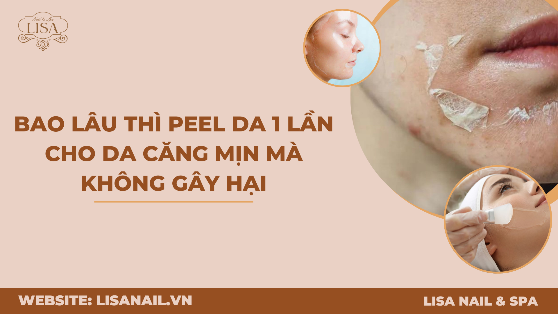 Bao lâu thì peel da 1 lần cho da căng mịn mà không gây hại
