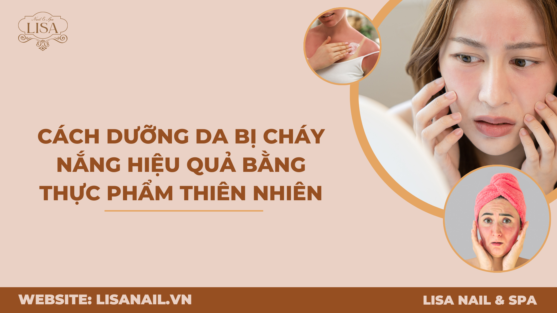 Cách dưỡng da bị cháy nắng hiệu quả bằng thực phẩm thiên nhiên