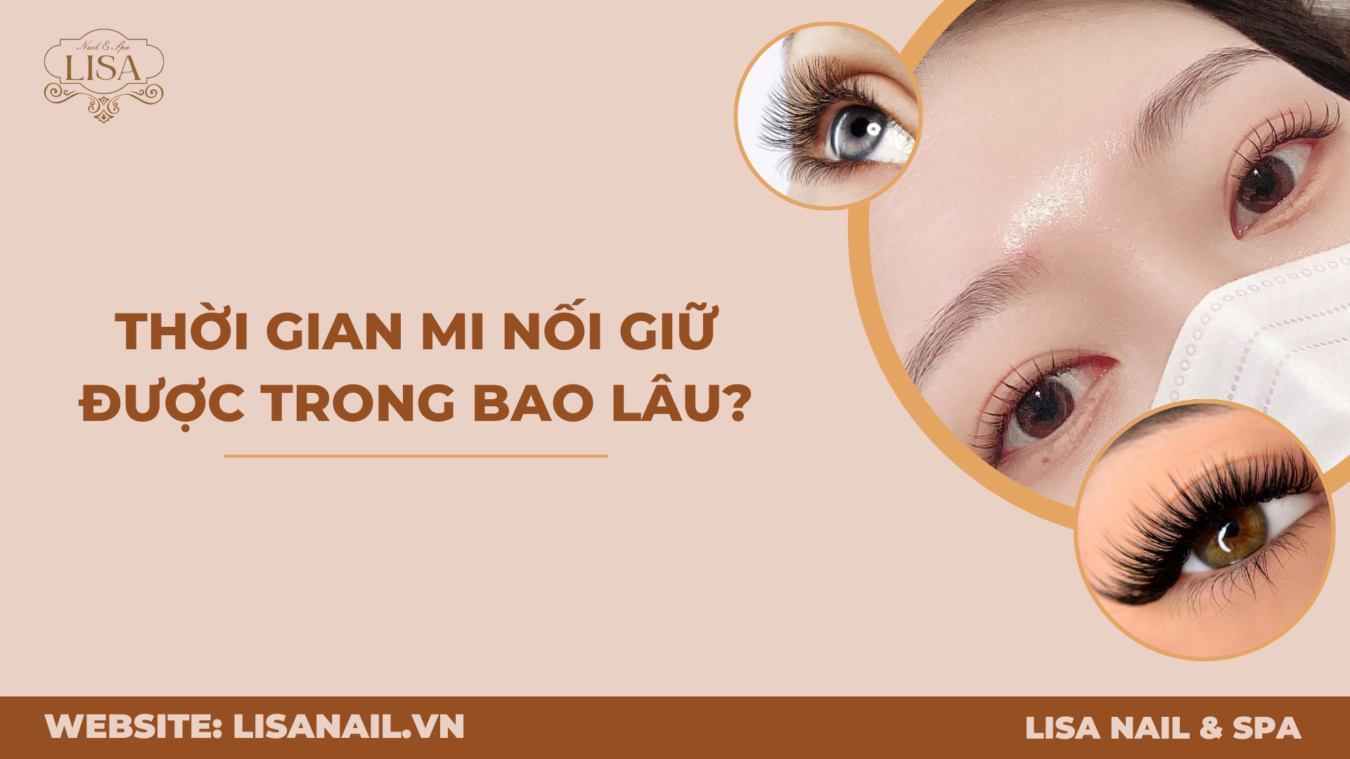 Thời gian mi nối giữ được trong bao lâu?