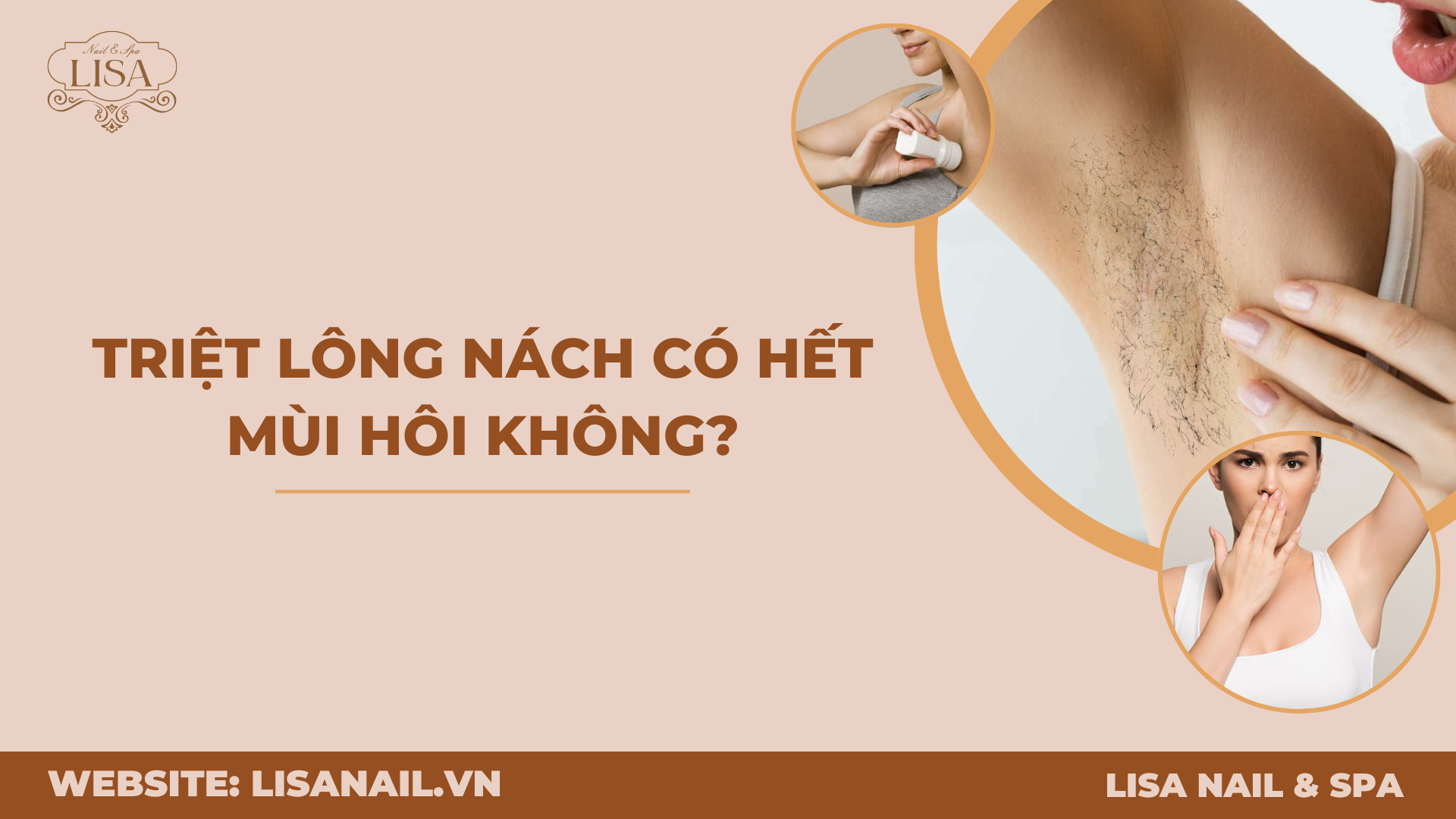 Triệt lông nách có hết mùi hôi không?