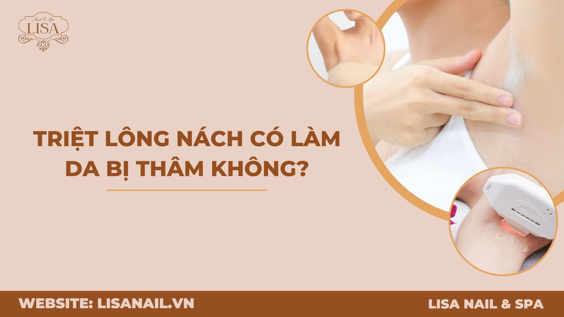 Triệt lông nách có làm da bị thâm không?