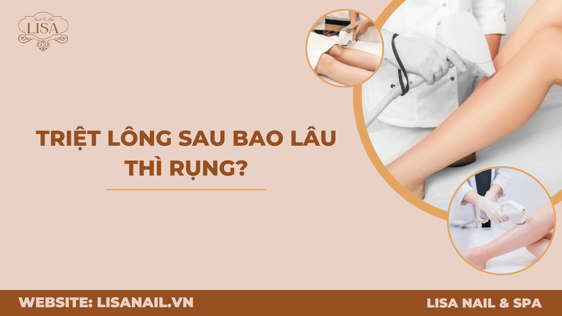 Triệt lông sau bao lâu thì rụng?