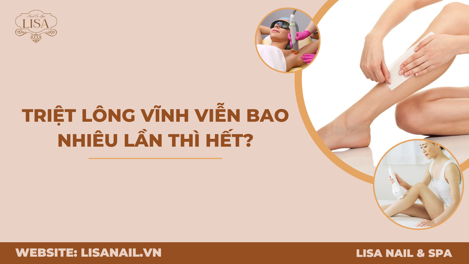 Triệt lông vĩnh viễn bao nhiêu lần thì hết?