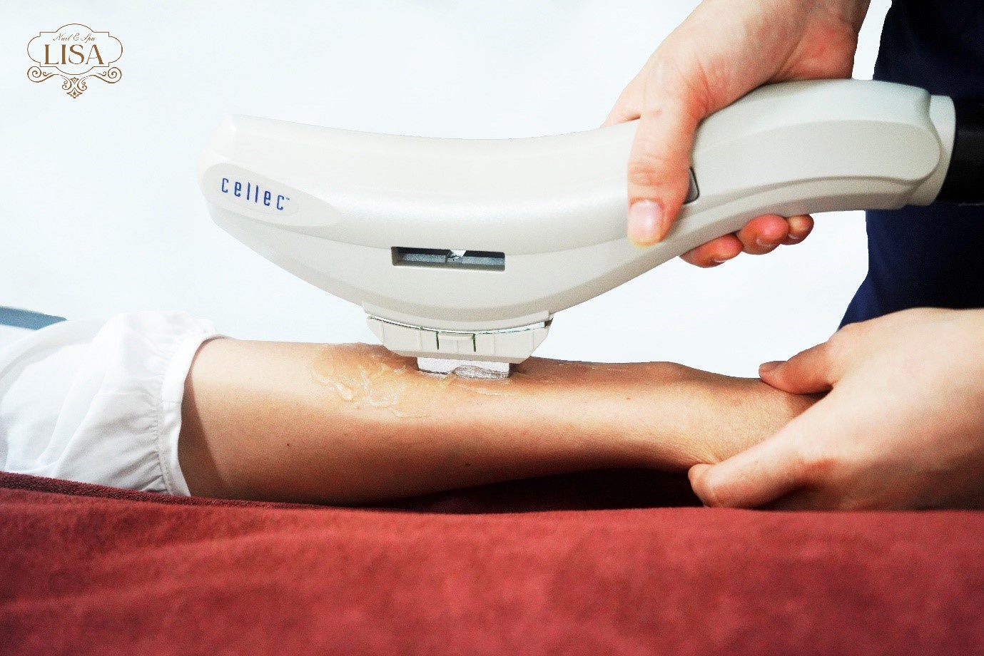 Triệt lông vĩnh viễn cellec