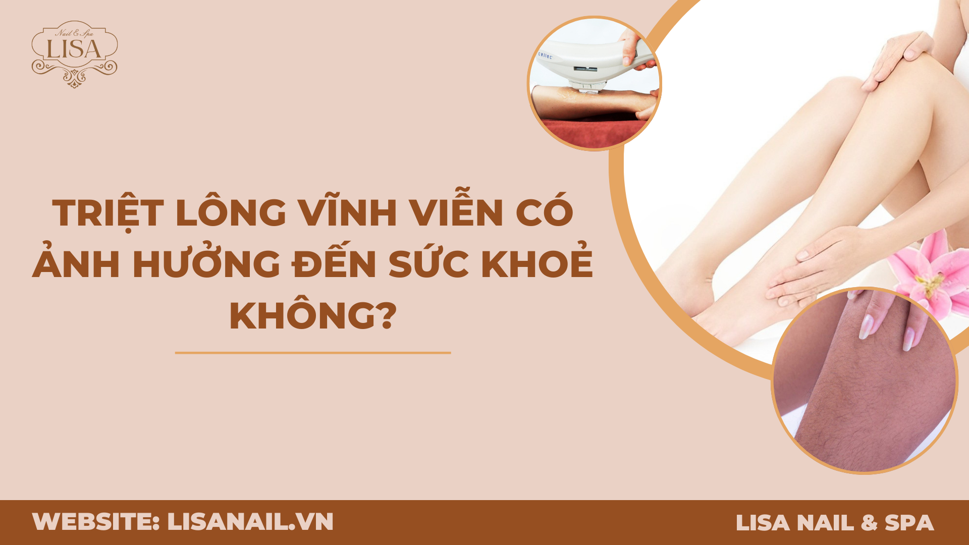 Triệt lông vĩnh viễn có ảnh hưởng đến sức khoẻ không?