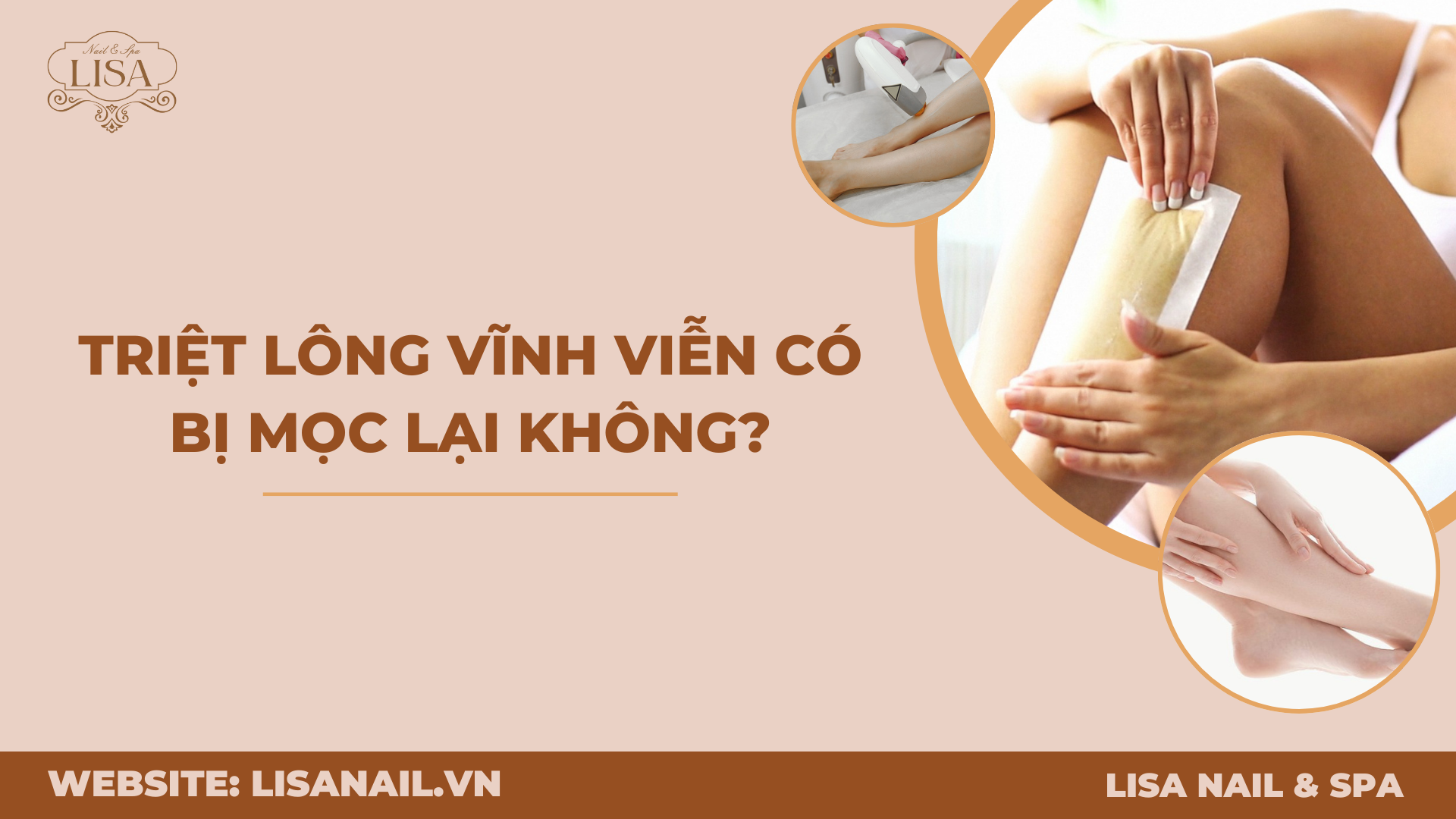 Triệt lông vĩnh viễn có bị mọc lại không?