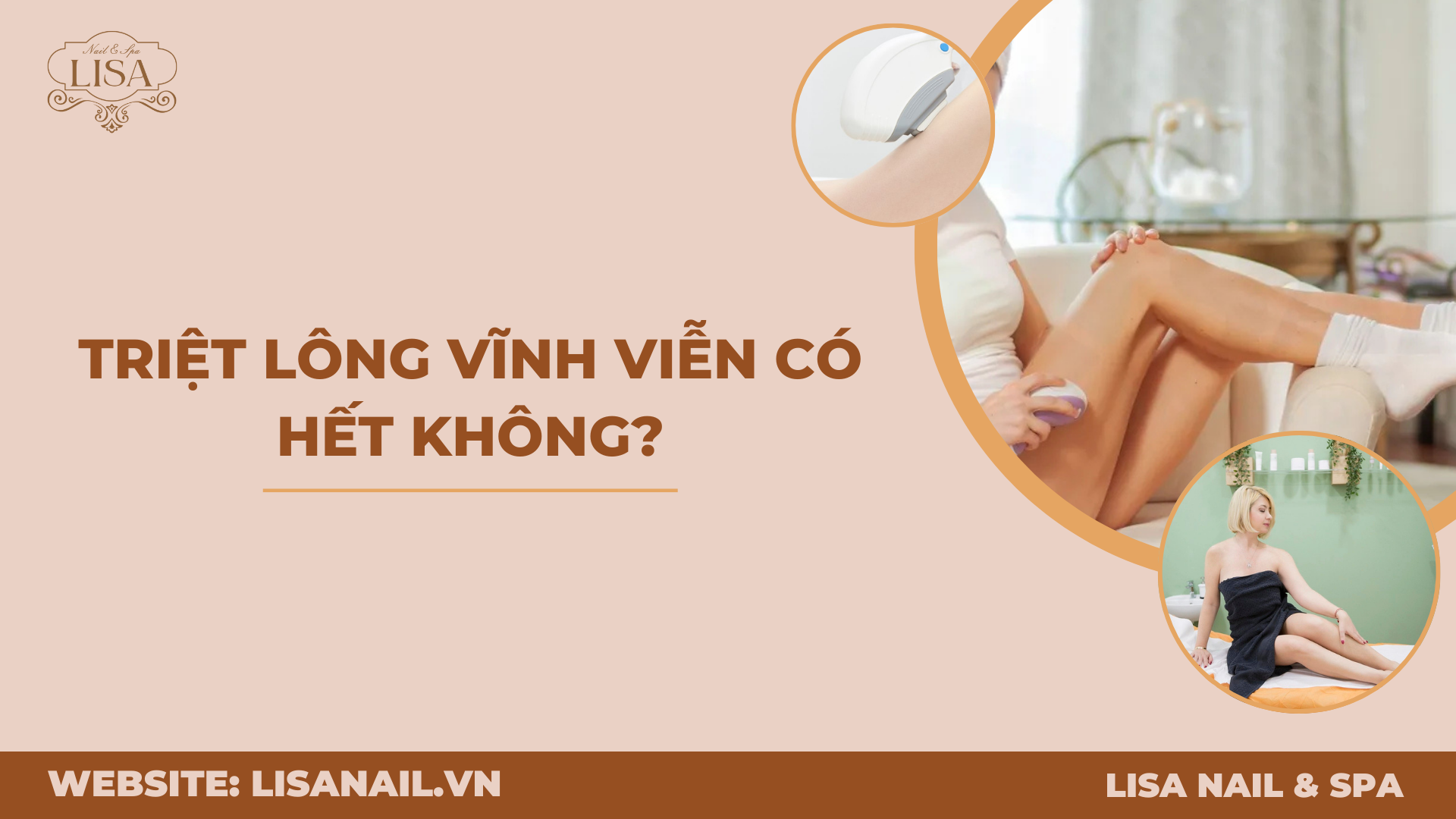 Triệt lông vĩnh viễn có hết không?