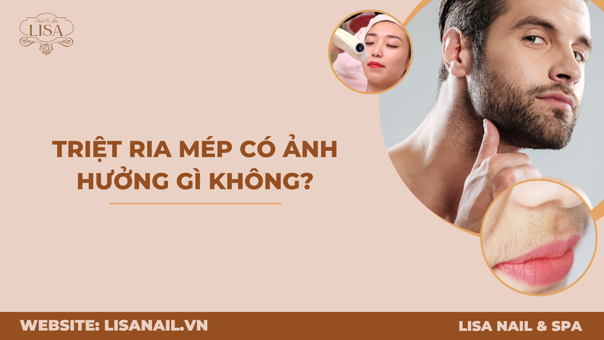 Triệt ria mép có ảnh hưởng gì không?