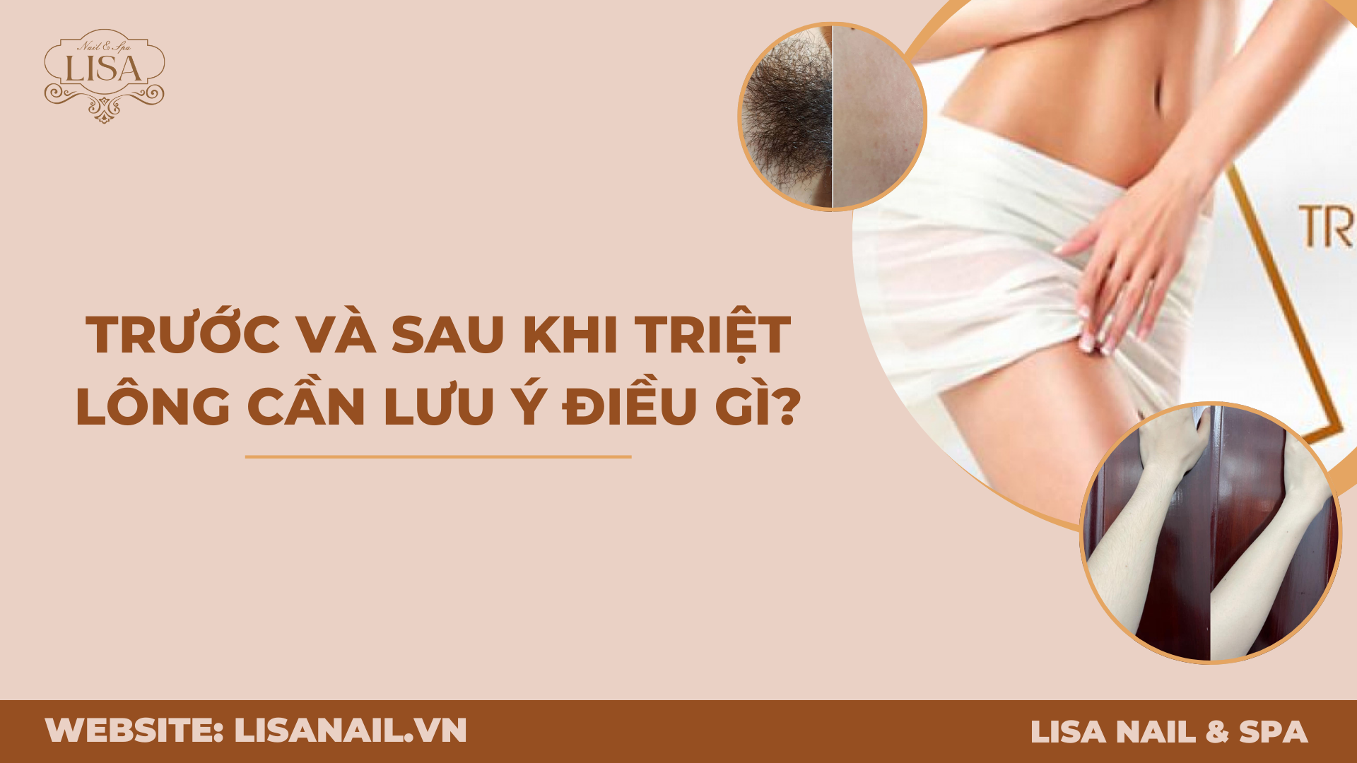 Trước và sau khi triệt lông cần lưu ý điều gì?