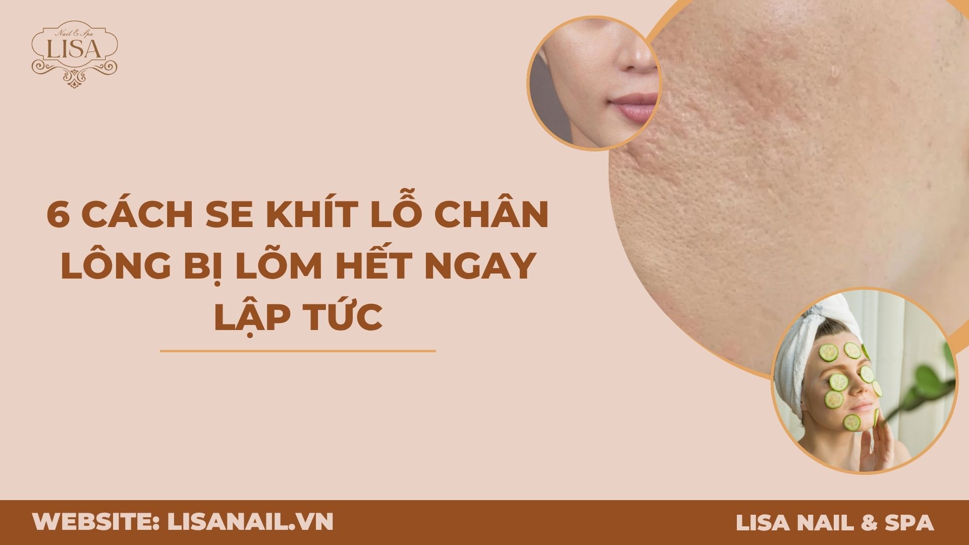 6 cách se khít lỗ chân lông bị lõm hết ngay lập tức