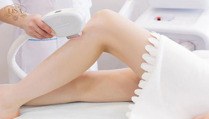 spa triệt lông spa triệt lông