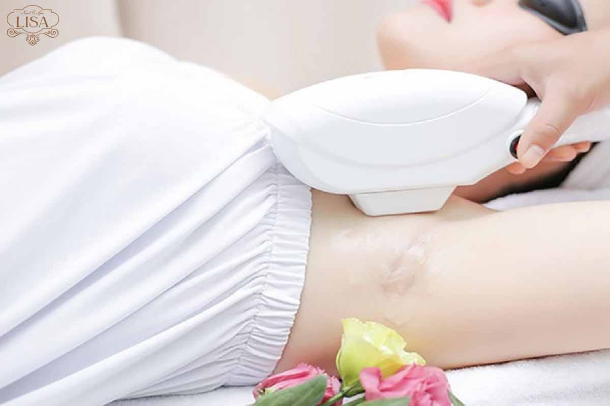 spa triệt lông spa triệt lông