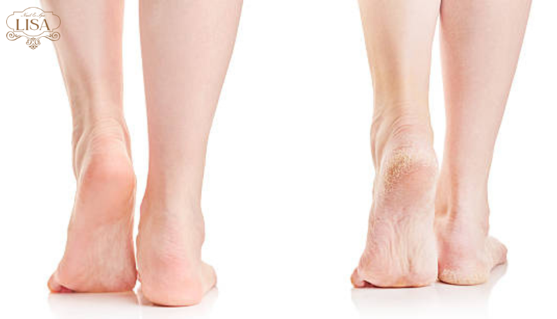 foot scrub treatment ho chi minh foot scrub treatment ho chi minh