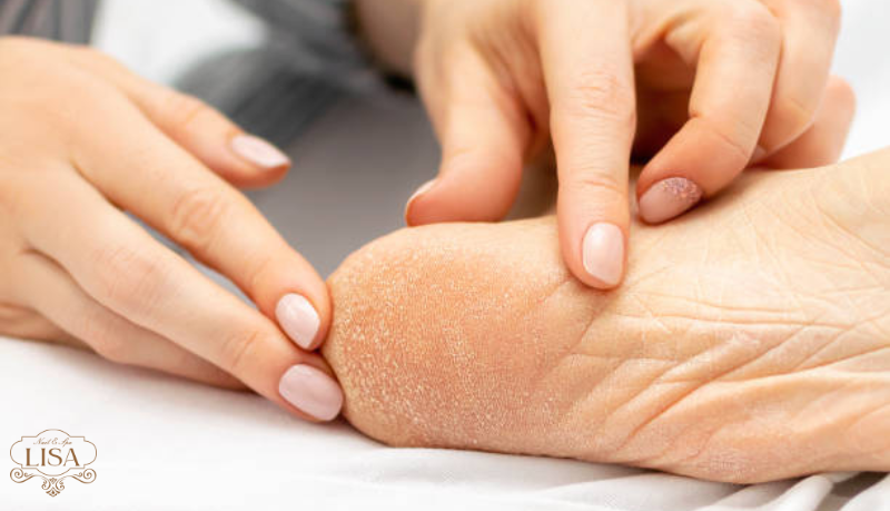 chà gót chân trị nứt nẻ chà gót chân trị nứt nẻ